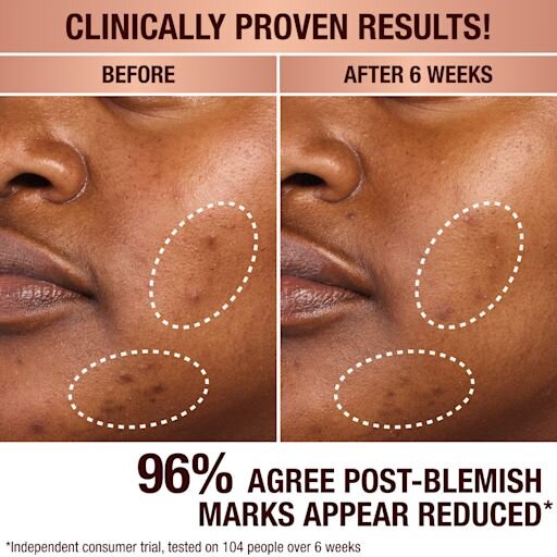 DARK SPOT CORRECTING RADIANCE RECOVERY SERUM 10 ML
